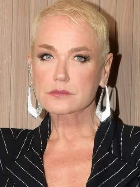 Xuxa fez transplante capilar Xuxa fez transplante capilar