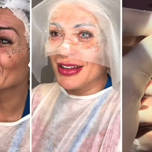 Andressa Urach: Clínica posta vídeo da cirurgia nos olhos