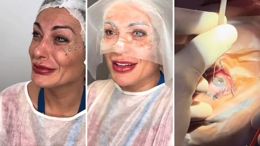 Andressa Urach Clínica posta vídeo da cirurgia nos olhos(02)