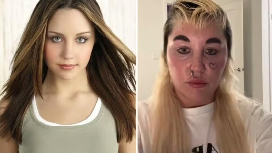 Amanda Bynes no auge do sucesso (à esquerda) e atualmente (à direita) Amanda Bynes no auge do sucesso (à esquerda) e atualmente (à direita)
