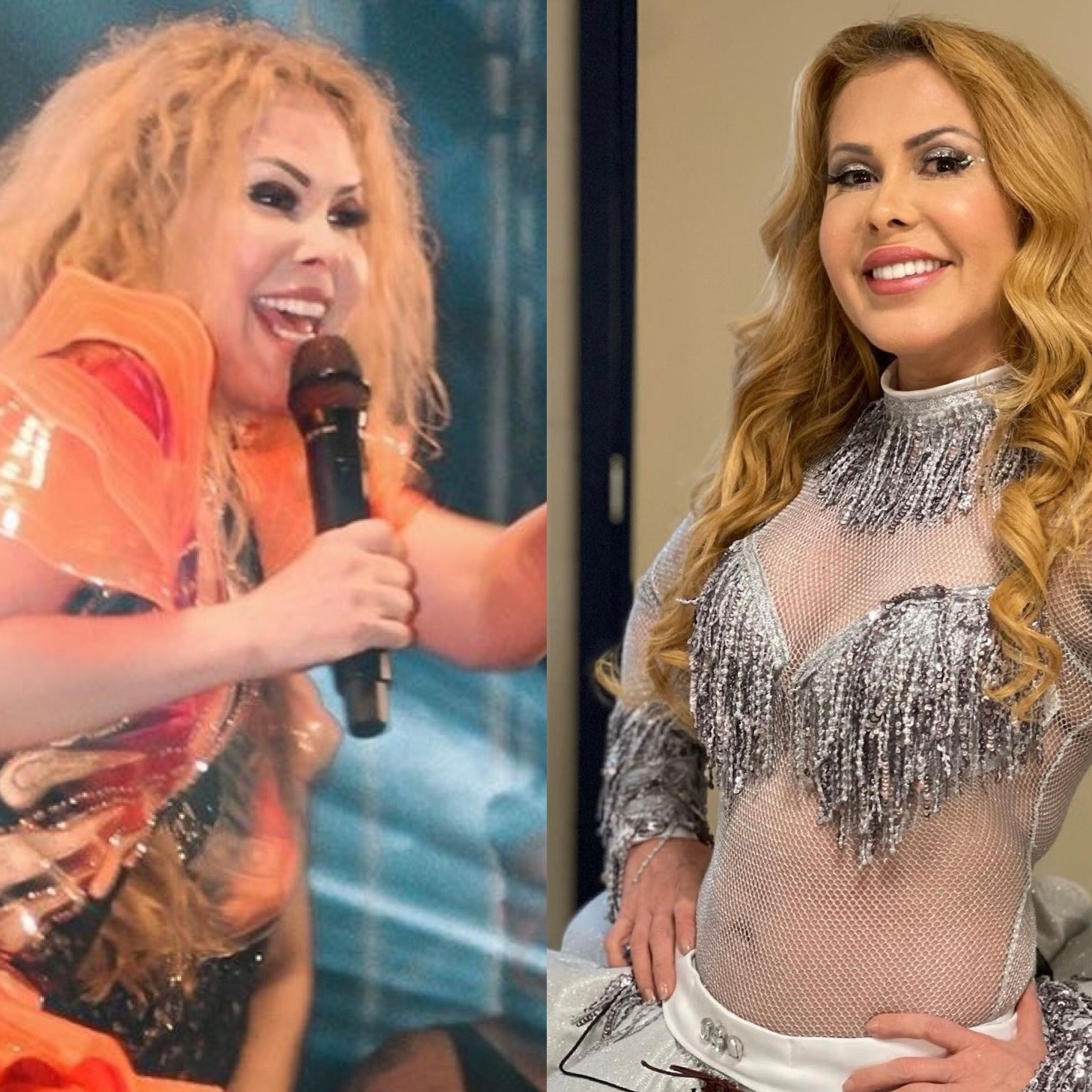 Joelma &eacute; internada com esofagite e edema ap&oacute;s pegar covid quatro vezes