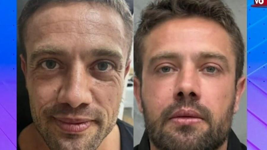 Rafael Cardoso mostra resultado de harmonização facial - Reprodução/SBT