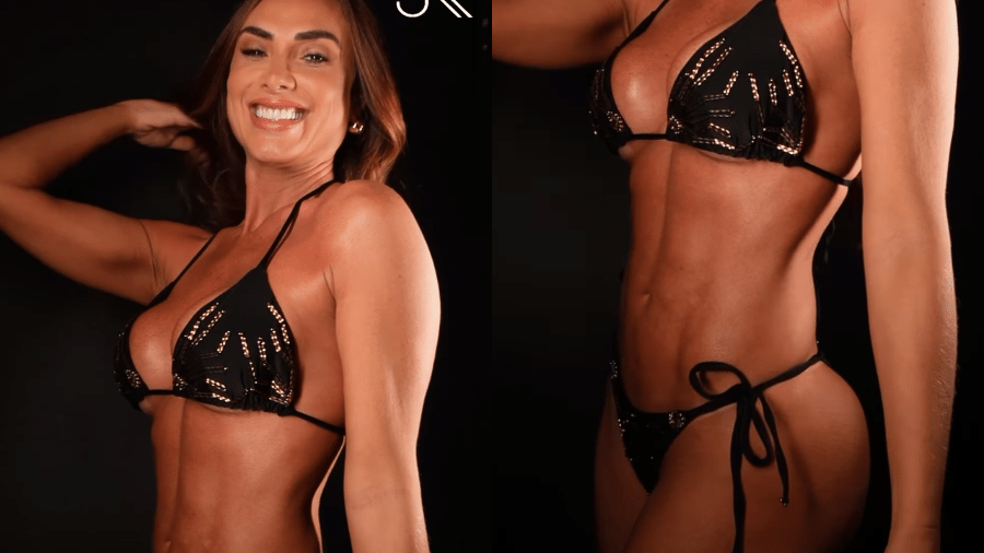Nicole Bahls mostra resultado de procedimento estético