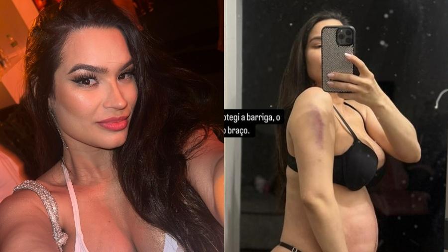 Grávida, Raissa Barbosa vai parar no hospital após se cair de escada Grávida, Raissa Barbosa vai parar no hospital após se cair de escada