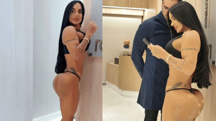 Kamila Simioni mostra procedimento no bumbum