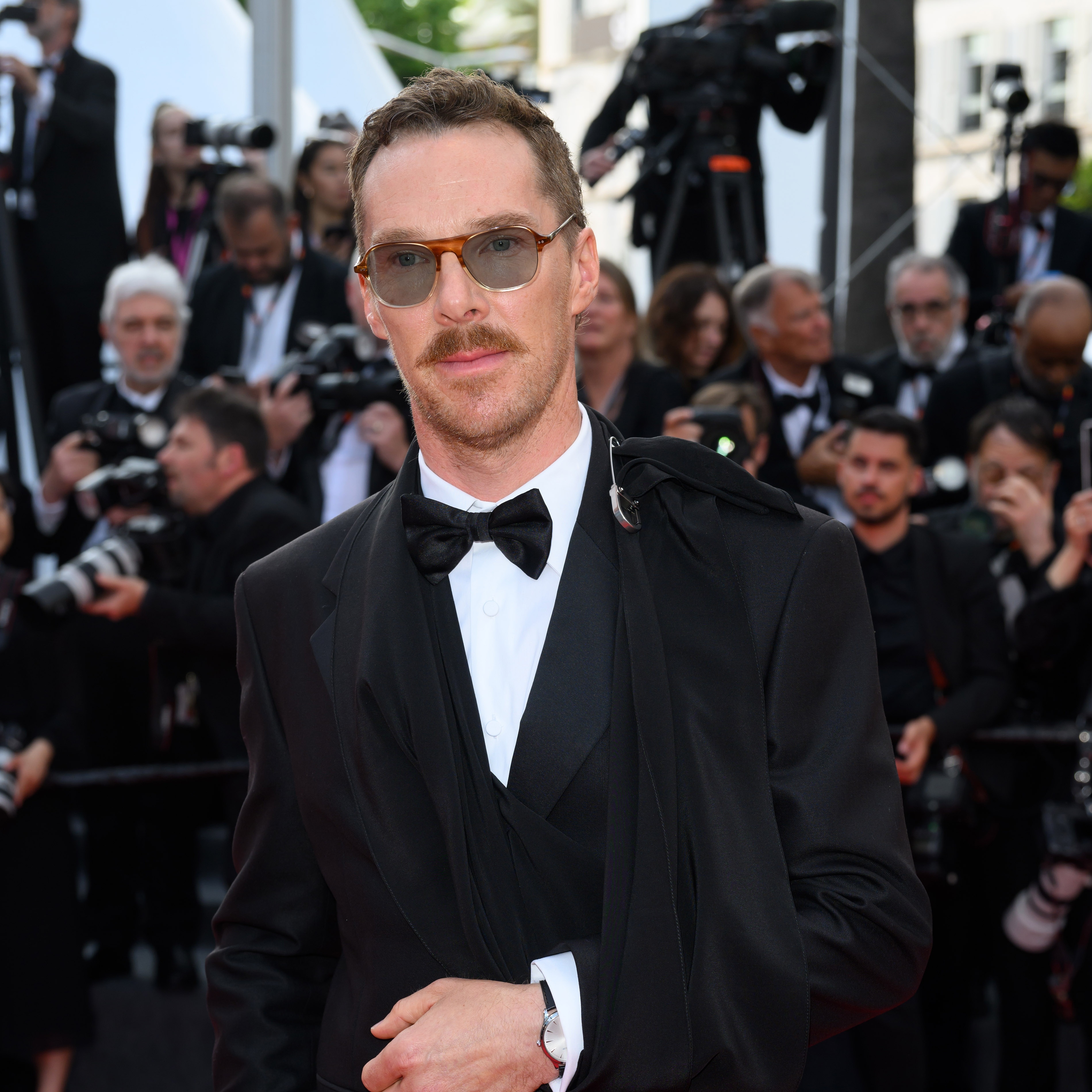 Benedict Cumberbatch: Ator revela cirurgia após acidente com surfe
