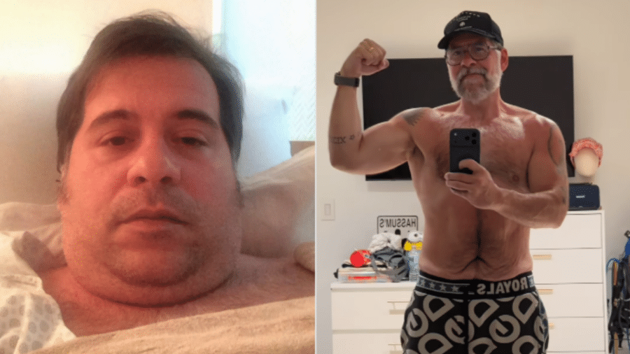 Leandro Hassum mostra antes e depois para comemorar bariátrica