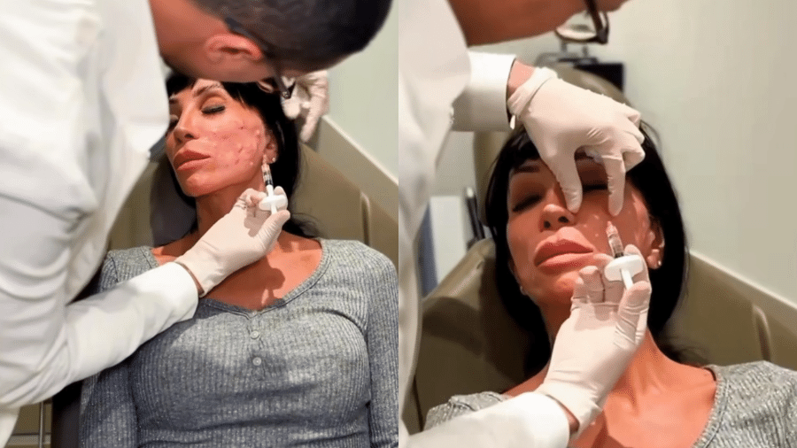 Maya Massafera faz procedimento estético com esperma de peixe - Reprodução/Instagram