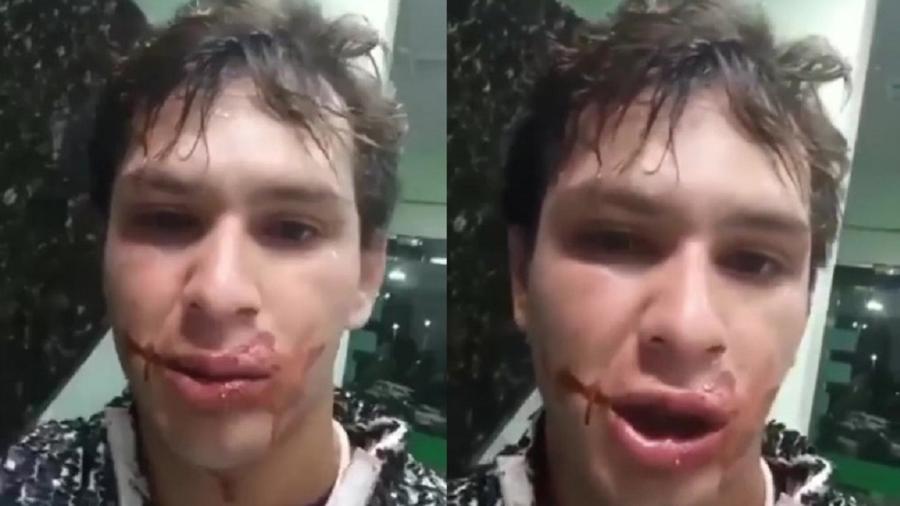 Adeildo B, repórter do SBT, aparece em vídeo após sofrer assalto em Manaus - Reprodução/Instagram