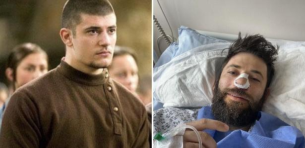 Ator de Harry Potter passa por cirurgia de emergência: 'Não podia respirar'