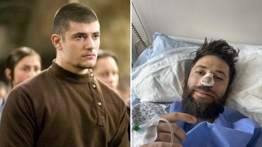Stanislav Ianevski, que interpretou Viktor Krum (à esquerda) em "Harry Potter", foi operado recentemente (à direita) - Reprodução/Warner/Instagram