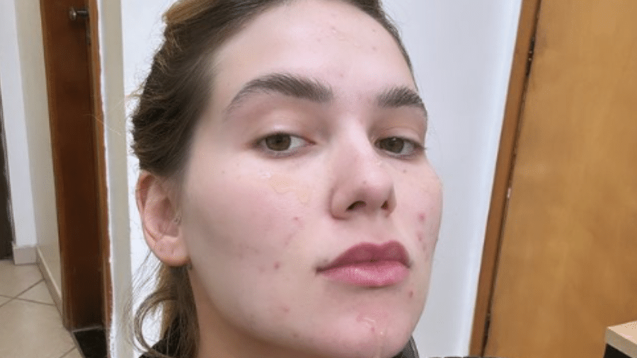 Virgínia Fonseca exibe o rosto antes de passar por uma sessão de make - Reprodução/Instagram