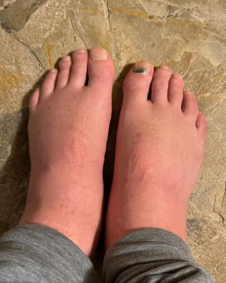 Os pés de Jamie Laing Os pés de Jamie Laing