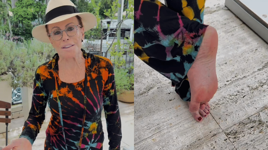 Ana Maria Braga mostra picada de escorpião no pé