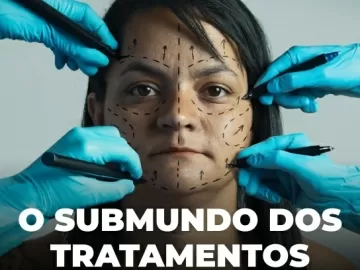 Do botox ao PMMA, Brasil concentra intervenções que são caso de polícia