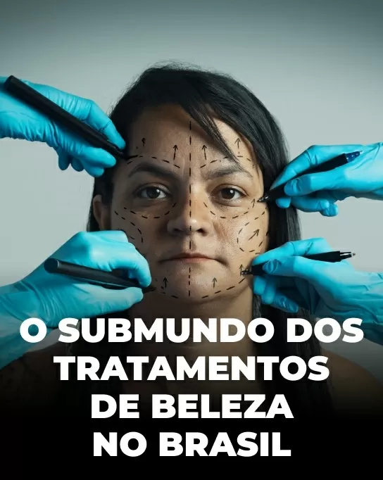 Do botox ao PMMA, Brasil concentra intervenções que são caso de polícia