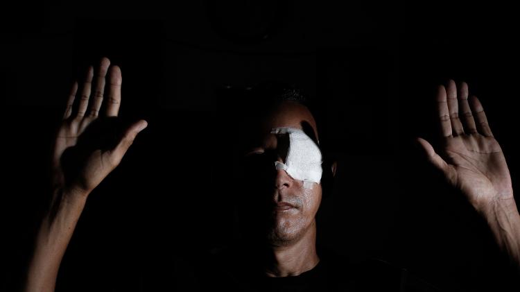 Daniel Campelo, atingido no olho por uma bala de borracha em 29 de maio, em protesto contra o governo de Jair Bolsonaro, no Recife - Brenda Alcântara/UOL - Brenda Alcântara/UOL