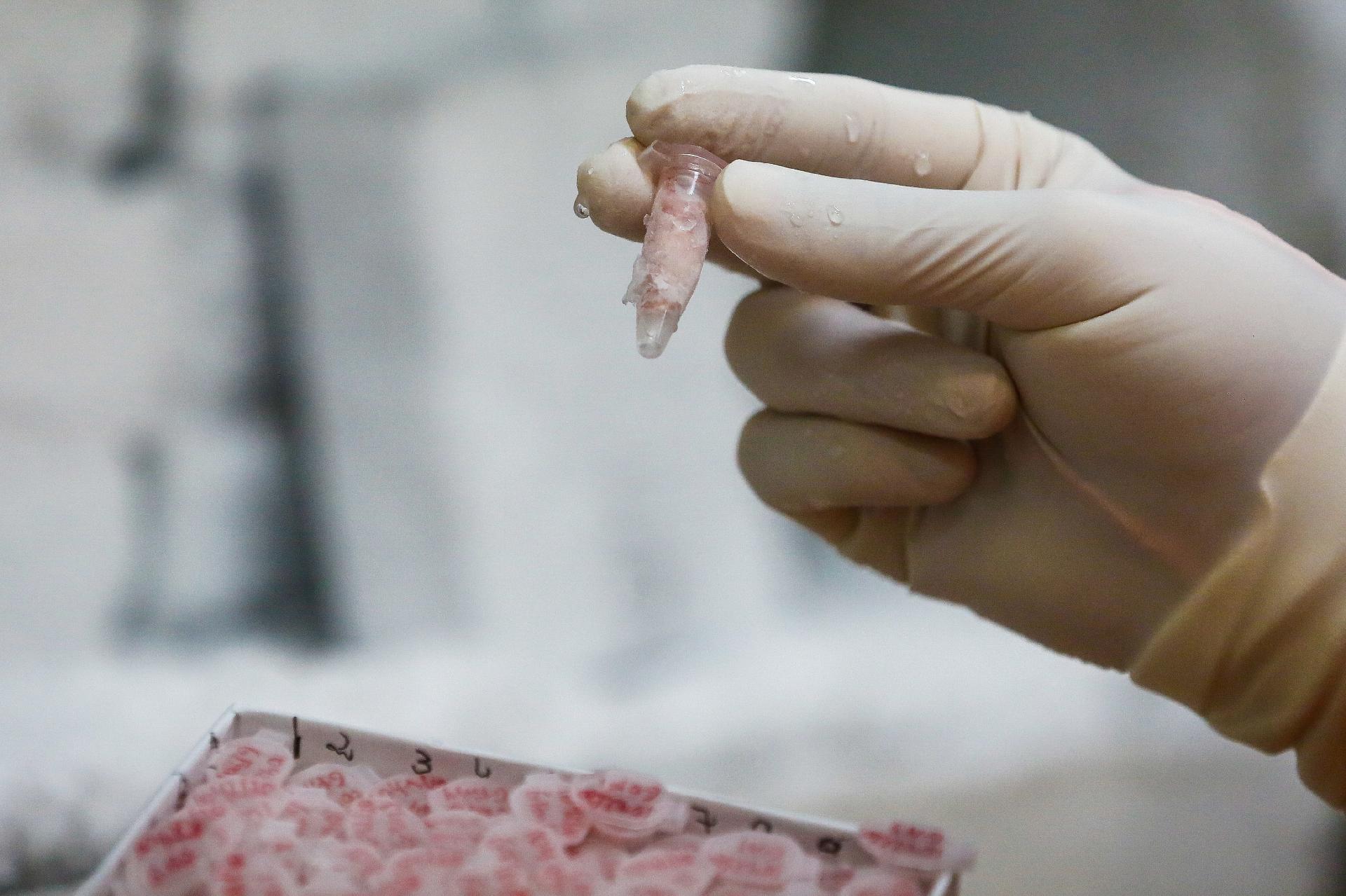 Técnico mostra um dos 50 tubos em que é dividido cérebro doado e congelado para estudo na Faculdade de Medicina da USP - Flávio Florido/UOL