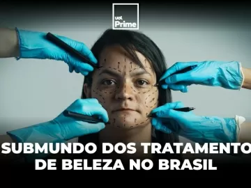 Do botox ao PMMA, Brasil concentra intervenções que são caso de polícia