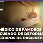 Médico de famosos é acusado de deformar corpo de mulheres