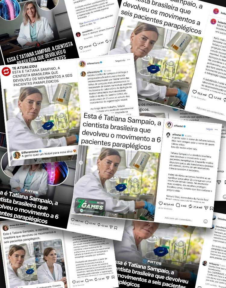 Montagem mostra publicações semelhantes sobre Tatiana Sampaio e polilaminina em perfis virais do Instagram - undefined