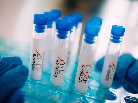 Coronavírus: Músico de 26 anos com sintomas de covid-19 morre no ...