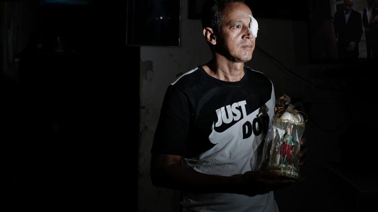 Daniel Campelo, cidadão atingido no olho por bala de borracha em protesto no dia 29 de maio, no Recife - Brenda Alcântara/UOL - Brenda Alcântara/UOL