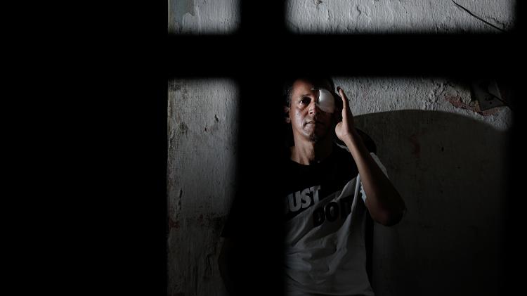 Daniel Campelo perdeu o olho esquerdo ao ser atingido por uma bala de borracha disparada pela PM de Recife em 29 de maio  - Brenda Alcântara/UOL - Brenda Alcântara/UOL