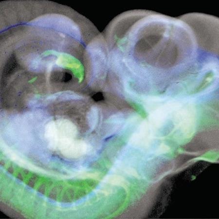 Imagem mostra tomografia tridimensional de um feto de camundongo depois de dez dias de gestação, - Divulgação/Science