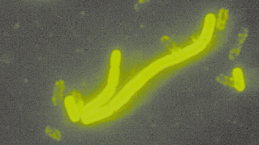 Ilustração representa a bactéria Yersinia pestis; exames foram feitos para averiguar caso de mulher de São Gonçalo com suspeita da doença - CDC/Divulgação