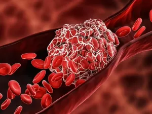 Desvendando os caminhos da anticoagulação: os remédios, riscos e benefícios