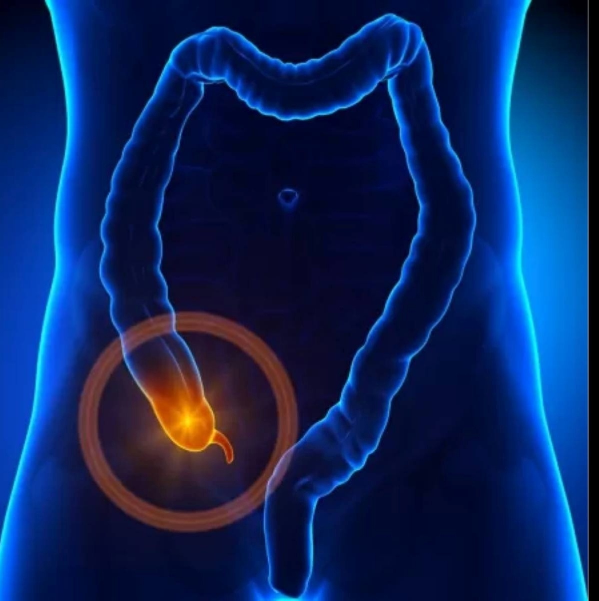 Dor No Apendice Humano Dor Ou Inflamação No Intestino. Intestino,